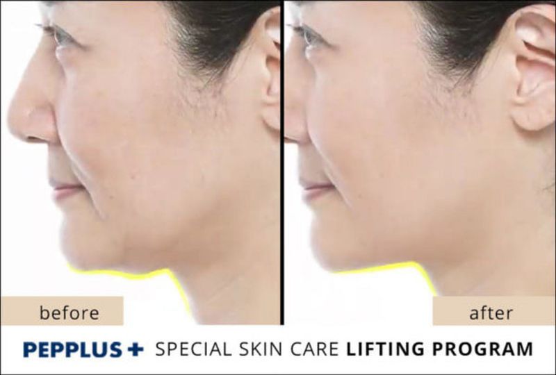 PEPPLUS Special Lifting Program - 4 masks