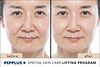 PEPPLUS Special Lifting Program - 4 masks