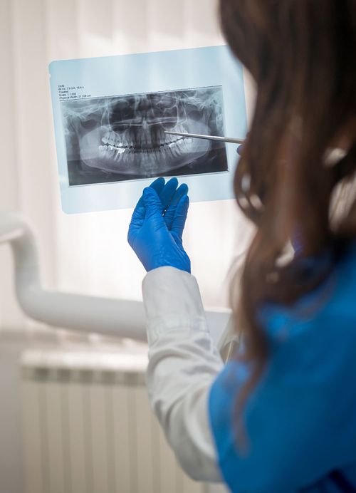 Xrays