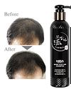 MOBALA Herbal Anti Hair Loss Shampoo