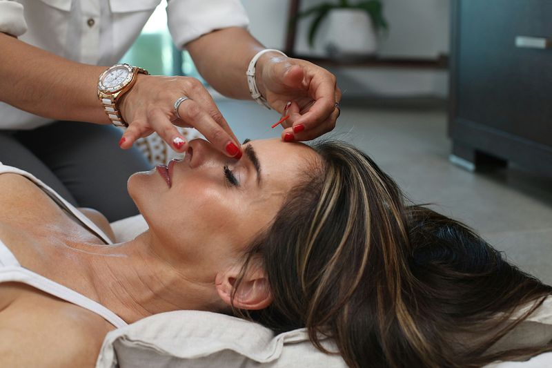 The Benefits of Acupuncture in Brussels: A Holistic Approach to Health