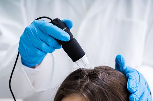 Scalp Analysis