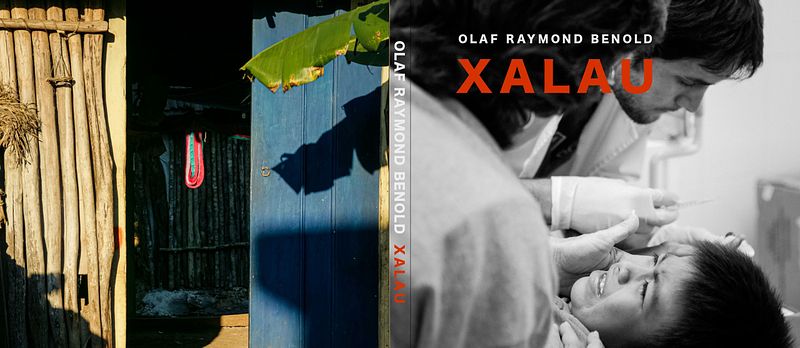 Xalau-Un pueblo y una clínica en Yucatán