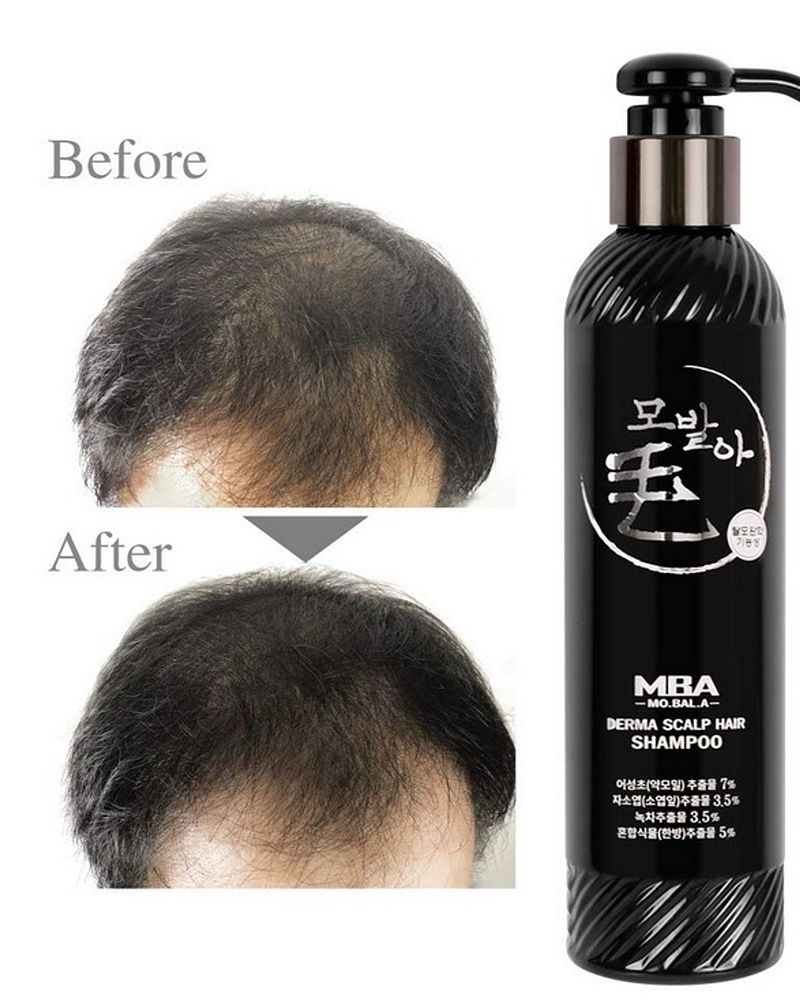 MOBALA Herbal Anti Hair Loss Shampoo